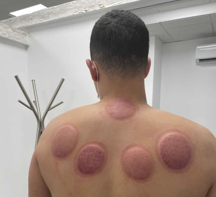 cupping en Granada
